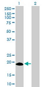 IFNA17 Antibody in Western Blot (WB)