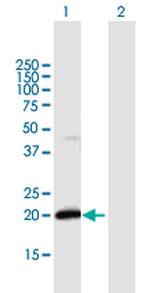 IFNA21 Antibody in Western Blot (WB)