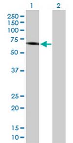 IFNAR1 Antibody in Western Blot (WB)