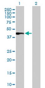 IFNAR2 Antibody in Western Blot (WB)