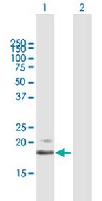 IFNB1 Antibody in Western Blot (WB)