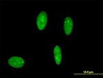 IFNR Antibody in Immunocytochemistry (ICC/IF)