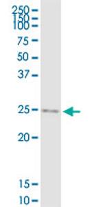 IGF2 Antibody in Western Blot (WB)