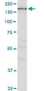 IGSF1 Antibody in Western Blot (WB)