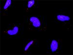 IKBKB Antibody in Proximity Ligation Assay (PLA) (PLA)