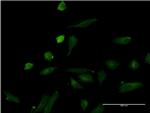 IL1A Antibody in Immunocytochemistry (ICC/IF)