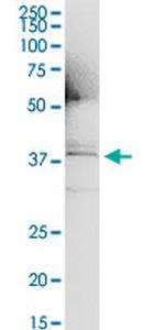 IL1A Antibody in Immunoprecipitation (IP)