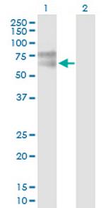 IL1R1 Antibody in Western Blot (WB)