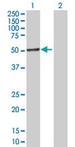 IL1RAP Antibody in Western Blot (WB)