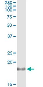 IL1RN Antibody in Immunoprecipitation (IP)