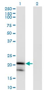 IL1RN Antibody in Western Blot (WB)