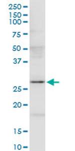 IL7 Antibody in Western Blot (WB)