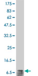 IL8 Antibody in Western Blot (WB)