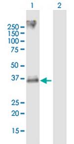 CXCR2 Antibody in Western Blot (WB)