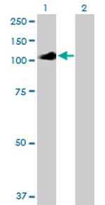 IL12RB2 Antibody in Western Blot (WB)