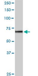 IL12RB2 Antibody in Western Blot (WB)