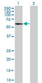 IL13RA1 Antibody in Western Blot (WB)