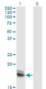 IL15 Antibody in Western Blot (WB)