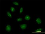 IL16 Antibody in Immunocytochemistry (ICC/IF)