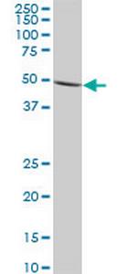 IMPDH1 Antibody in Western Blot (WB)