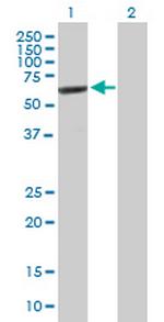 IMPDH2 Antibody in Western Blot (WB)