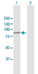 INPP5B Antibody in Western Blot (WB)