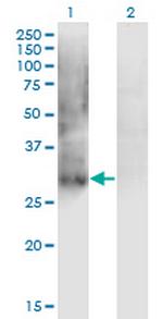 IPF1 Antibody in Western Blot (WB)