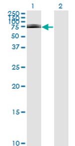 IRAK1 Antibody in Western Blot (WB)