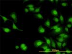 IRAK1 Antibody in Immunocytochemistry (ICC/IF)