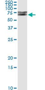 IRAK1 Antibody in Immunoprecipitation (IP)