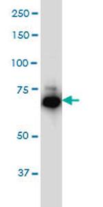 IRAK1 Antibody in Western Blot (WB)