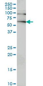 IRAK2 Antibody in Western Blot (WB)