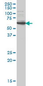 IRAK2 Antibody in Western Blot (WB)