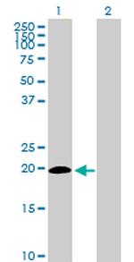 ISG20 Antibody in Western Blot (WB)