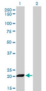 ISG20 Antibody in Western Blot (WB)