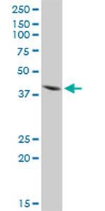 ISL1 Antibody in Western Blot (WB)