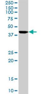 ISL1 Antibody in Western Blot (WB)