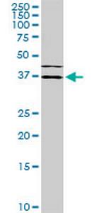 ISL1 Antibody in Western Blot (WB)