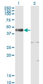 ISL1 Antibody in Western Blot (WB)