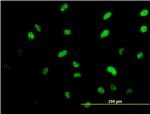 ISL1 Antibody in Immunocytochemistry (ICC/IF)