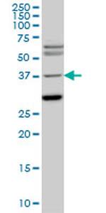 ISL1 Antibody in Western Blot (WB)