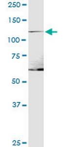 ITGA1 Antibody in Western Blot (WB)