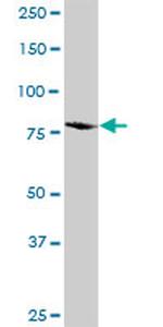 ITGB5 Antibody in Western Blot (WB)