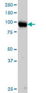 ITGB5 Antibody in Western Blot (WB)