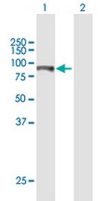 ITPKB Antibody in Western Blot (WB)