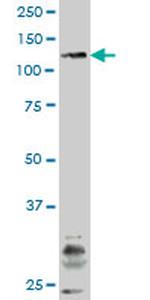 JAK3 Antibody in Western Blot (WB)