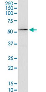 KCNA3 Antibody in Western Blot (WB)