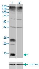 KCNE1 Antibody in Western Blot (WB)