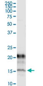 KCNE1 Antibody in Immunoprecipitation (IP)