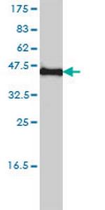 KCNF1 Antibody in Western Blot (WB)